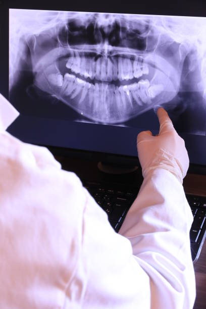 Best Emergency Treatment for Dental Infections or Abscesses in Ol, LA