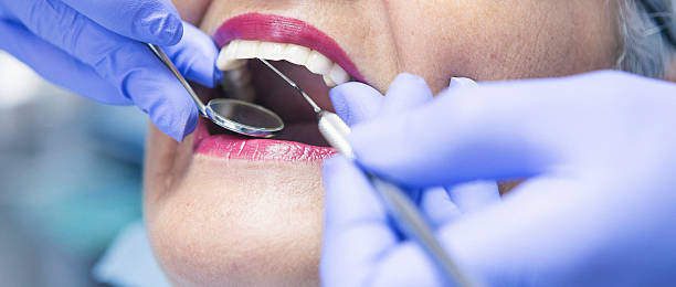 Fast & Reliable Emergency Dental Services in LA